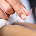 Boosting Energy and Vitality with Acupuncture
