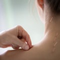 The Power of Acupuncture for Chronic Conditions