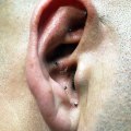 Auricular Acupuncture: A Comprehensive Guide to Pain Relief and Holistic Healing