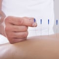 Acupuncture for Spiritual Well-Being: Unlocking the Mind-Body Connection