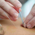 Exploring the Benefits of Nutrition and Acupuncture for Holistic Healing