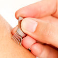 All You Need to Know About Japanese Acupuncture