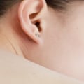 Acupuncture for Pain Relief: Understanding Traditional Chinese Medicine