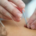 Acupuncture for Fertility and Pregnancy: Unlocking the Benefits of Traditional Chinese Medicine