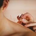 Understanding Holistic Healing Through Acupuncture