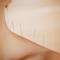 Understanding the Benefits of Acupuncture for Depression and Mood Disorders