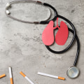 Smoking Cessation Through Acupuncture: A Comprehensive Guide to Holistic Healing