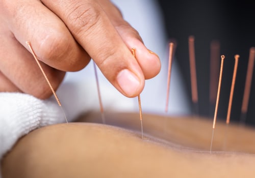 Boosting Energy and Vitality with Acupuncture