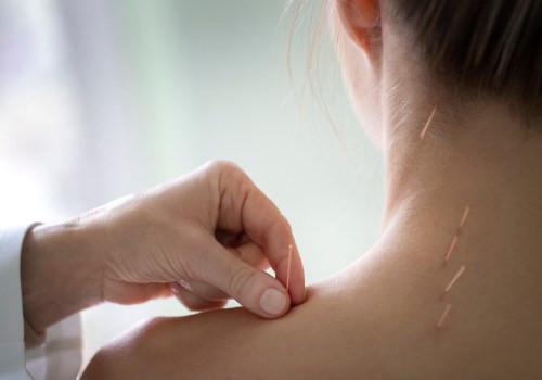 The Power of Acupuncture for Chronic Conditions