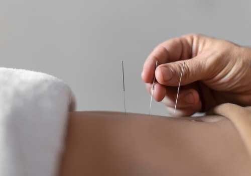 Acupuncture for Digestive Issues: The Holistic Approach to Pain Relief