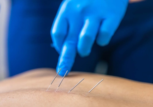 Understanding Acupuncture Needles: A Comprehensive Guide