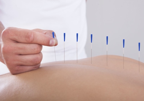 Acupuncture for Spiritual Well-Being: Unlocking the Mind-Body Connection