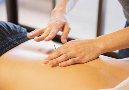 Holistic Healing Through Massage and Acupuncture