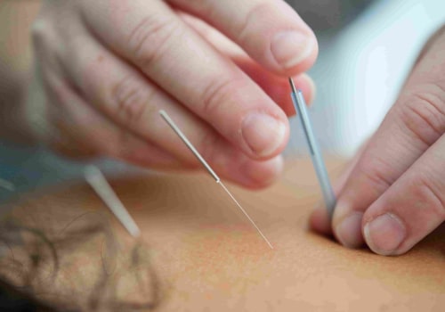 Exploring the Benefits of Nutrition and Acupuncture for Holistic Healing