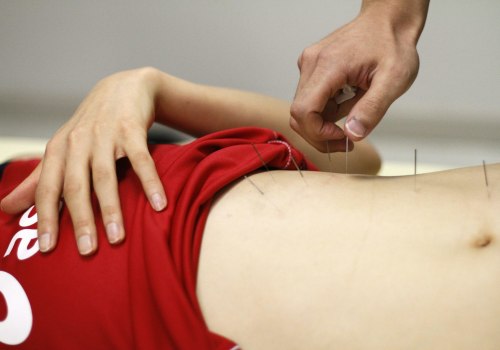 Sports Injuries Treated with Acupuncture
