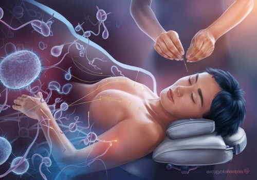 Improving Immune System with Acupuncture