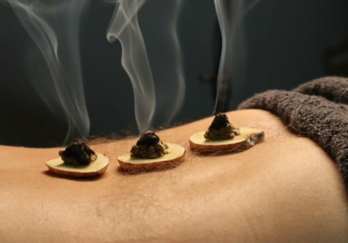 Understanding Moxibustion: The Benefits and Techniques of Acupuncture