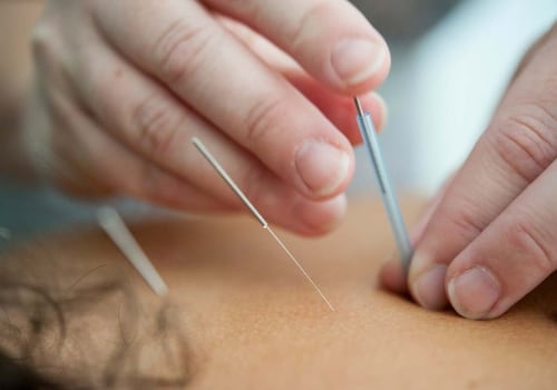 Acupuncture for Fertility and Pregnancy: Unlocking the Benefits of Traditional Chinese Medicine