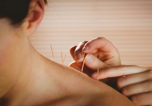 Understanding Holistic Healing Through Acupuncture