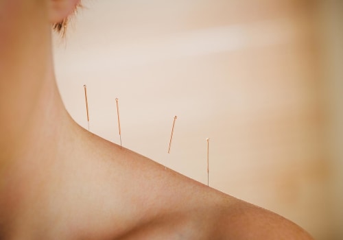 Understanding the Benefits of Acupuncture for Depression and Mood Disorders