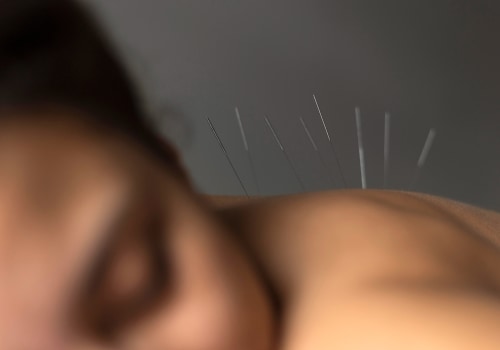 Addressing Emotional and Mental Health with Acupuncture: A Holistic Approach