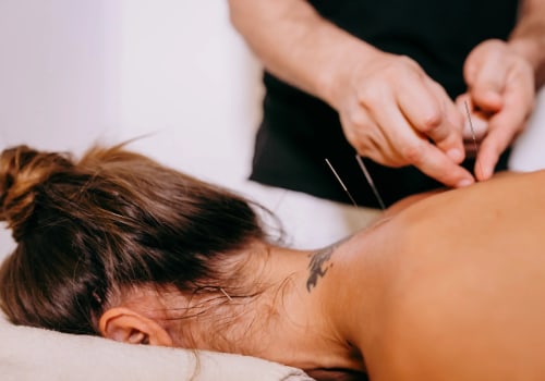 Understanding Preventative Care with Acupuncture